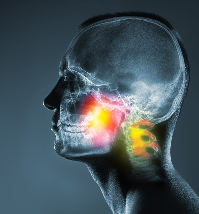 craniofacial conditions